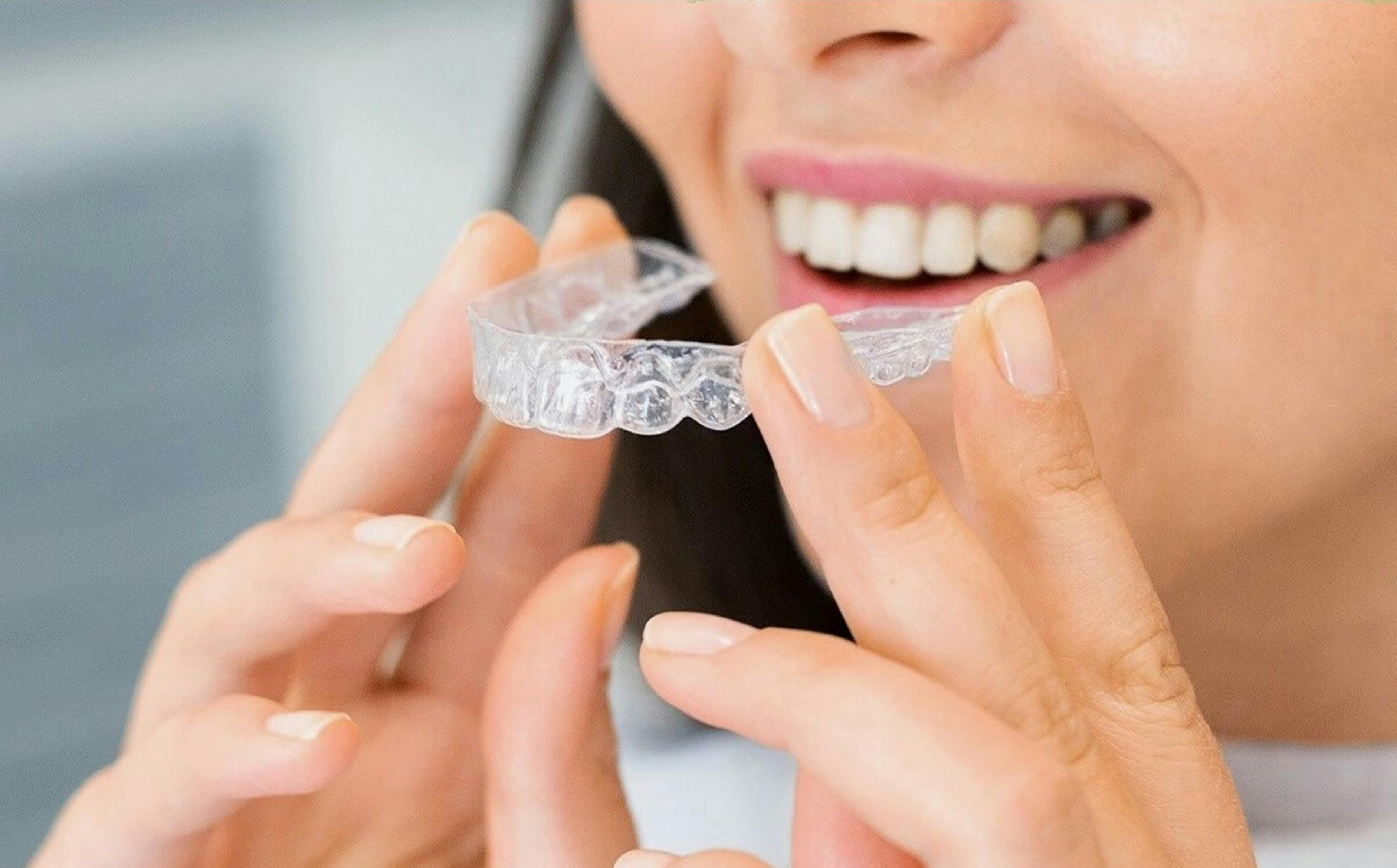 Invisible Aligners
